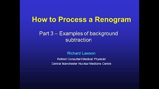 How to Process a Renogram Part3 [upl. by Jaeger]