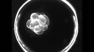 Blastocysts  5 Things IVF Patients Should Know [upl. by Ognimod]