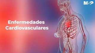 Enfermedades cardiovasculares [upl. by Suzanne]