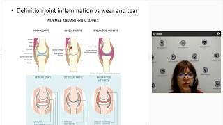 How do you treat Psoriatic Arthritis An Overview [upl. by Braswell]