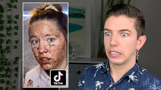 Specialist Reacts to Skin Care TikTok FAILS [upl. by Maddi]