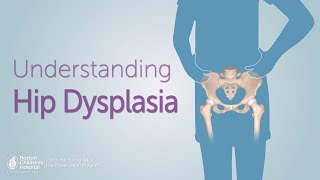 Congenital Hipdysplasia  How to measure angles [upl. by Aihsekram717]