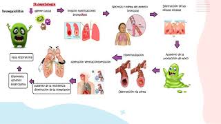 Bronquiolitis parte 1FisiopatologíaPediatría [upl. by Uba]