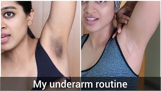 How I Got Rid of My Dark Underarms [upl. by Nylyak985]