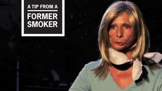 CDC Tips From Former Smokers  Terrie H’s Story [upl. by Modesta]