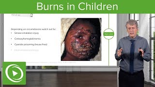 Burns in Children – Pediatrics  Lecturio [upl. by Sykleb]