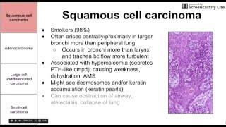 quotWhat is Adenocarcinoma The SHOCKING Truth Revealedquot [upl. by Dygert]