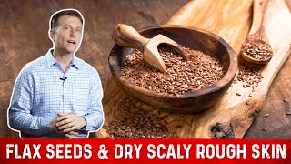 Flaxseed Benefits for Skin amp Symptoms of Linoleic Acid Deficiency – Dr Berg [upl. by Kask827]