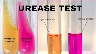 Urea Hydrolysis Urease Test [upl. by Matthei]