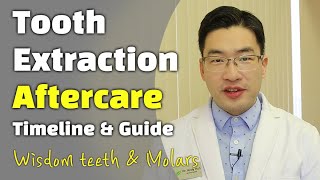 Aftercare Instruction Tooth Extraction Wisdom teeth removal molars front teeth Evergreen Dental [upl. by Ettenor106]