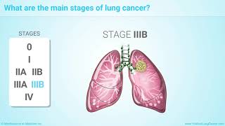 Lung Cancer Screening  American Lung Association  Ad Council [upl. by Joliet209]