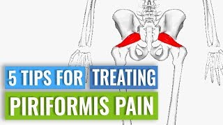 Treatment for Piriformis Pain [upl. by Elleivad654]