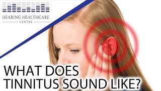 What Does Tinnitus Sound Like [upl. by Roldan]