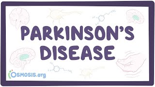 Approach to the Exam for Parkinsons Disease [upl. by Frieder]