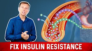 7 Things That Boost Insulin Sensitivity or Reverse Insulin Resistance  Dr Berg [upl. by Lananna]