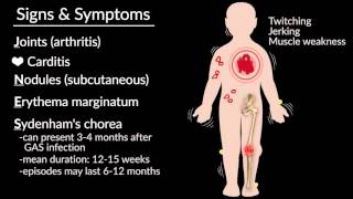 Acute Rheumatic Fever by E Rusingiza  OPENPediatrics [upl. by Aneris242]