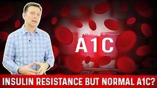 Normal A1C But Why Do I have Insulin Resistance – Dr Berg [upl. by Naghem]