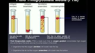 Basics of Fluid Thioglycollate Media FTM  With Examples [upl. by Allisan888]