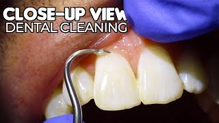 Dental Cleaning  CloseUp View ASMR [upl. by Prue]