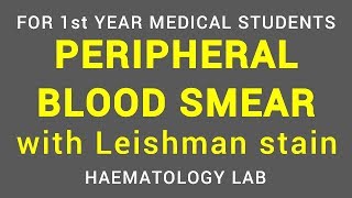 PERIPHERAL BLOOD SMEAR  LEISHMAN STAIN  HAEMATOLOGY LAB  PHYSIOLOGY [upl. by Sherrill719]