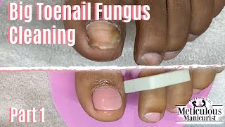 How To Pedicure Toenail Fungus Home Remedy Cleaning Part 1 [upl. by Clarabelle]