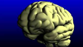 2Minute Neuroscience Brain Aneurysms [upl. by Leonora]