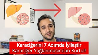 Karaciğerini 7 Adımda İyileştir Karaciğer Yağlanması Tanı ve Tedavisi [upl. by Hubie]