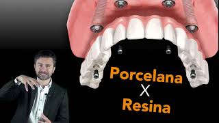 Implante Dentário Porcelana ou Resina [upl. by Anairol]