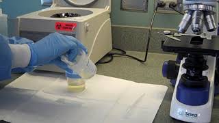 Preparing a Urine Specimen for Microscopic Examination [upl. by Oj]