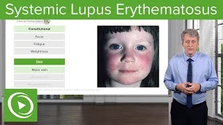 Systemic Lupus Erythematosus SLE in Children – Pediatrics  Lecturio [upl. by Sadowski]