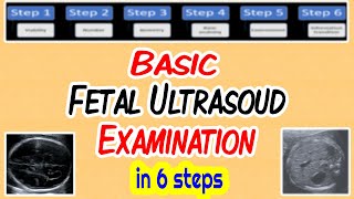 Basic Fetal Ultrasound Examination [upl. by Jutta178]