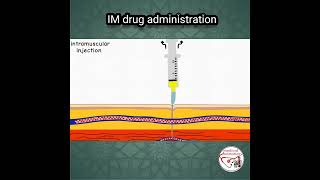 💉 INTRAMUSCULAR IM INJECTION PROCEDURE  ANIMATED EXPLANATION [upl. by Korwun]