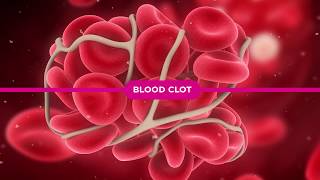 Coagulation Cascade Explained [upl. by Gerard824]