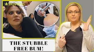 Laser Hair Removal On The Bum  How to Remove Hair From Bum [upl. by Nylimaj367]