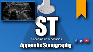 Appendix Ultrasound [upl. by Yael]