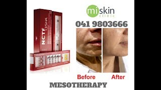 Filorga NCTF Mesotherapy [upl. by Notpmah]