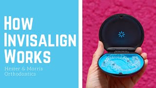 How Invisalign Works [upl. by Etnoj]