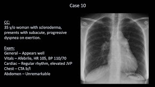 How to Interpret a Chest XRay Lesson 10  Self Assessment Part 2 [upl. by Assile715]