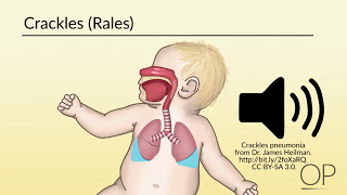 Respiratory Assessment by B Leary L DelSignore  OPENPediatrics [upl. by Gorman]