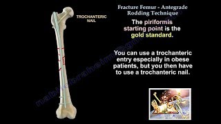 FEMUR  BONES OF LOWER LIMB  ANATOMY  SIMPLIFIED ✔ [upl. by Voorhis407]