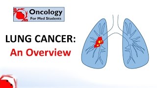 Lung Cancer An Overview [upl. by Aria]