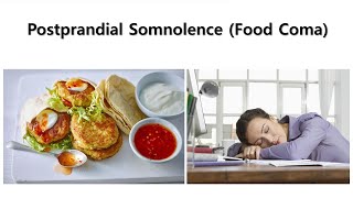 Postprandial Somnolence Food Coma [upl. by Ranique]