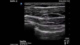 Pectoral muscles scanning [upl. by Yerffoj183]