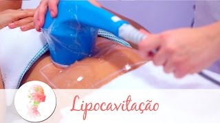 Lipocavitação tratamento estético reduz gordura localizada [upl. by Lednic]