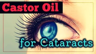 Castor Oil For Cataracts Does It Work And How To Use It [upl. by Rausch]