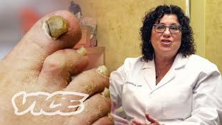 Meet a Toenail Fungus Expert [upl. by Anayia]