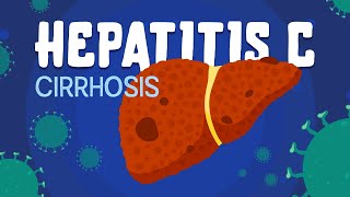 A Deep Dive into Hepatitis C [upl. by Egwan]