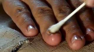 How to Cure Nail Fungus [upl. by Oiromed512]