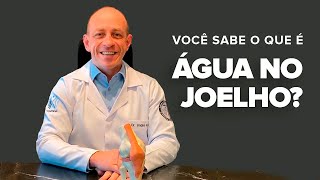 VOCÊ SABE O QUE É quotÁGUA NO JOELHOquot DrANDRÉ KRUEL [upl. by Eelanna]