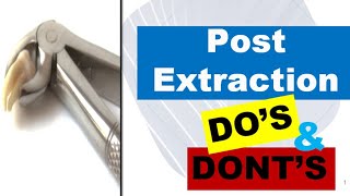 DENTAL POST EXTRACTION INSTRUCTIONS [upl. by Tani]